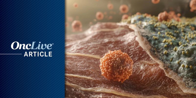 黑色素瘤新突破：基因检测或可让部分患者免于淋巴结活检手术