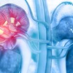 透明细胞肾细胞癌（RCC）诊断新突破：ITM-94显像剂获FDA快速通道资格