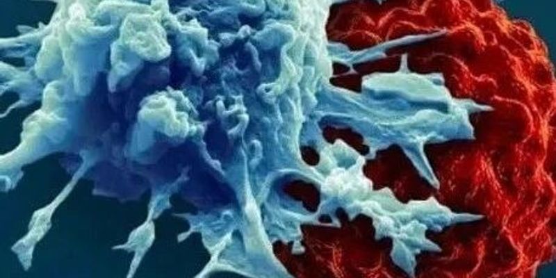 NK细胞疗法：癌症治疗新曙光？晚期肝癌控制率超80%