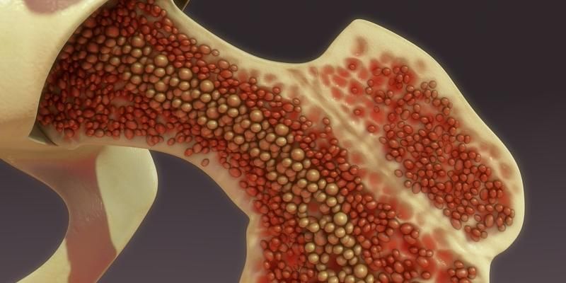 软组织肉瘤新希望：Mecbotamab Vedotin临床试验显示总生存期显著改善