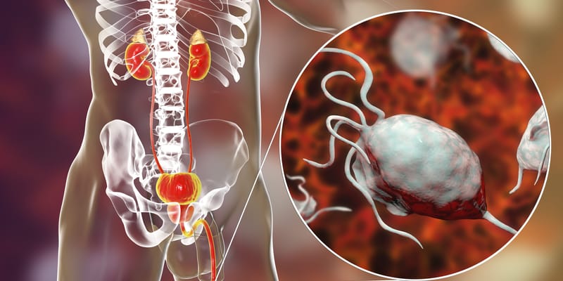 达罗他胺新突破：ARASENS研究证实其显著改善高龄前列腺癌患者生存期
