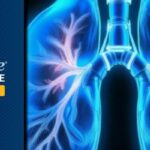 非小细胞肺癌治疗新突破：HER2、c-MET与KRAS等新兴生物标志物如何指导精准用药？