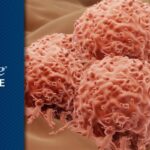 西米普利单抗(Cemiplimab)获欧盟批准：皮肤鳞癌术后辅助治疗新里程碑，显著降低复发风险