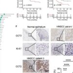 头颈鳞癌顺铂耐药新机制：CCT2-c-Myc轴成关键，靶向治疗迎新曙光