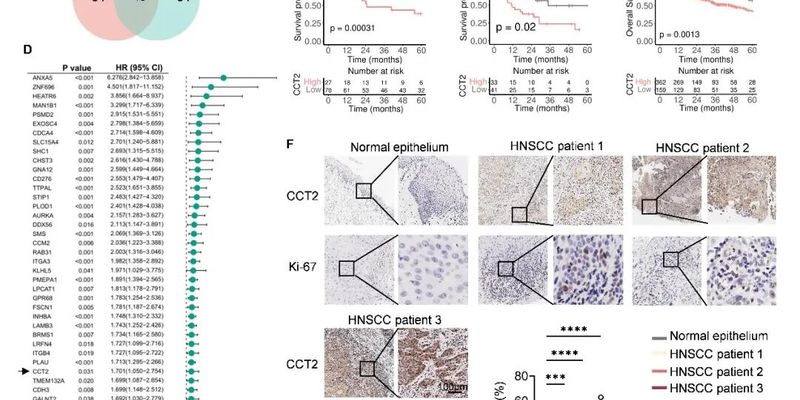 头颈鳞癌顺铂耐药新机制：CCT2-c-Myc轴成关键，靶向治疗迎新曙光
