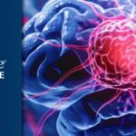 伏拉西尼显著延长生存期：IDH突变2级胶质瘤治疗迎来新突破