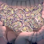 老年直肠癌新选择：短程放疗疗效显著，为不耐受化疗患者带来希望