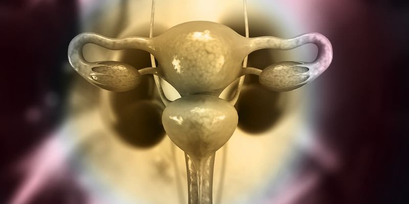 尼拉帕利一线维持治疗晚期卵巢癌：真实世界研究揭示其卓越疗效与安全性