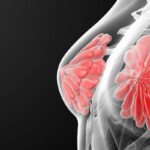 戈沙妥珠单抗一线治疗HR+/HER2-乳腺癌：ASCENT-07研究PFS未达标，OS现积极信号