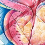 前列腺癌新突破：Sacituzumab Tirumotecan联合疗法II期研究客观缓解率达47%