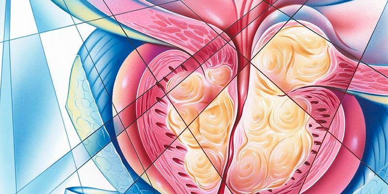 前列腺癌新突破：Sacituzumab Tirumotecan联合疗法II期研究客观缓解率达47%