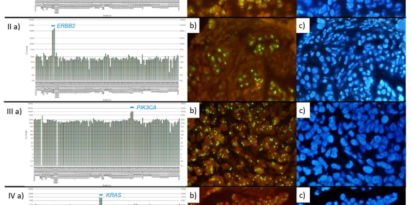 非小细胞肺癌精准治疗新选择：NGS检测MET/ERBB2基因扩增的可靠性获证实