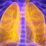 广泛期小细胞肺癌新突破：一线化疗免疫联合放疗显著改善患者预后