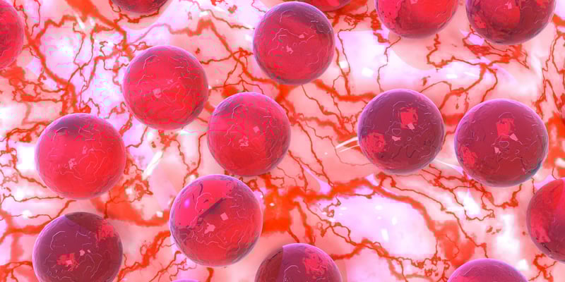 B细胞白血病(B-ALL)移植新曙光：EndRAD研究证实，放弃全身放疗(TBI)疗效依然显著