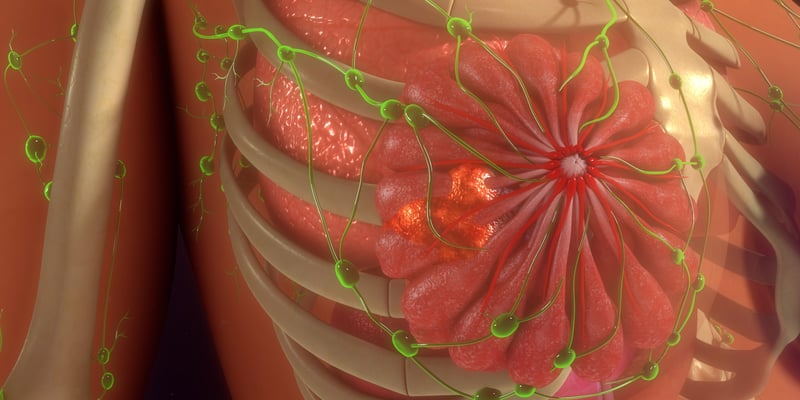 T-DXd（Enhertu）对比T-DM1：HER2阳性乳腺癌残留病灶术后辅助治疗最新疗效数据与购买渠道解析