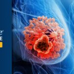 TNBC乳腺癌新辅助治疗后，ctDNA MRD检测如何精准预测远处复发风险？