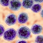 特利司他单抗联合达雷妥尤单抗：新诊断多发性骨髓瘤患者的治疗新突破