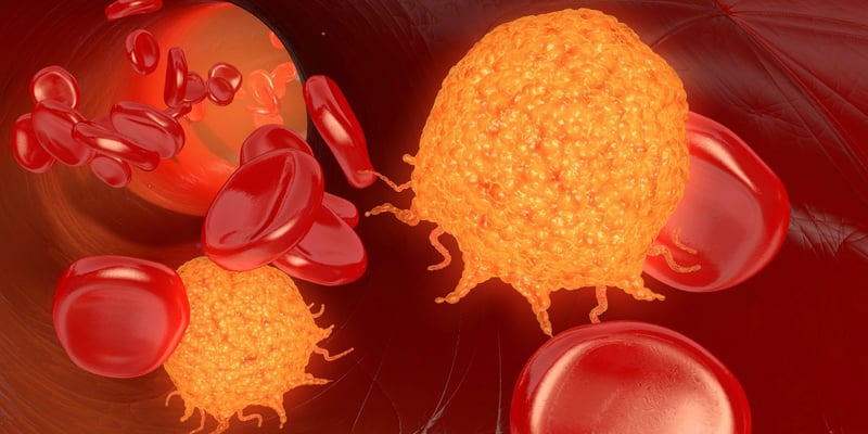 奥雷巴替尼一线治疗Ph+急性淋巴细胞白血病：全球关键3期临床试验获FDA与EMA批准