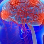 重大突破！新型癌症疫苗IGV-001治疗胶质母细胞瘤，中位总生存期延长超6个月