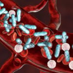 泽布替尼联合维奈克拉：初治慢性淋巴细胞白血病/小淋巴细胞淋巴瘤患者的持久希望