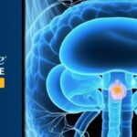 尿路上皮癌新突破：维恩妥尤单抗联合疗法副作用（周围神经病变）竟预示更长生存期？