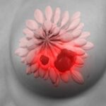 SABCS 2025乳腺癌最新进展：口服SERD、ADC疗效数据与免疫治疗新方案深度解读