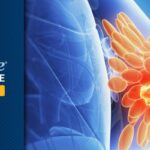 Sacituzumab Govitecan（Trodelvy）一线治疗HR+/HER2-乳腺癌PFS未达标，但OS早期趋势积极：解读ASCENT-07研究对患者的意义