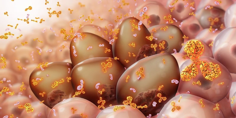 急性髓系白血病(AML)化疗：一项30年研究揭示黑人患者预后差异与NPM1突变影响