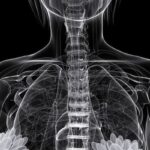 Camizestrant 治疗 ESR1 突变乳腺癌：PFS 延长超 7 个月，海外购买渠道与价格解析