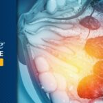 HR+/HER2+乳腺癌辅助治疗新进展：芳香化酶抑制剂显著改善DFS，优于他莫昔芬