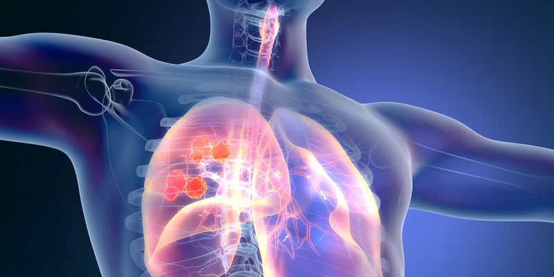 非小细胞肺癌治疗新篇章：双特异性抗体与抗体偶联药物的未来展望与临床突破