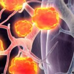 B7-H3 ADC新药risvutatug rezetecan：广泛期SCLC突破性疗法与临床数据深度解析