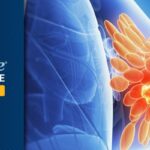 Sacituzumab Govitecan联合Pembrolizumab：PD-L1阳性三阴性乳腺癌一线治疗新标准？PFS达11.2个月