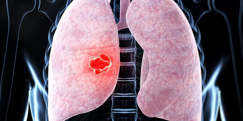 EGFR突变肺癌一线治疗：MARIPOSA vs FLAURA2，Amivantamab/Lazertinib对比Osimertinib化疗，哪个方案更优？
