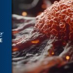 黑色素瘤与CSCC新辅助/辅助治疗新突破：Cemiplimab、Nivolumab最新疗效与海外购买渠道解析