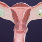 妇科肿瘤临床试验揭秘：为何卵巢癌新药多，而子宫癌、宫颈癌机会少？