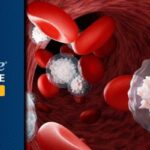 慢性淋巴细胞白血病(CLL)治疗新突破：ASH 2025解读CLL17与BRUIN研究，匹托布鲁替尼数据亮眼