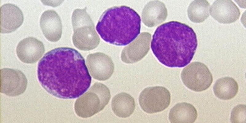 泽布替尼（Zanubrutinib）一线CLL/SLL治疗新突破：6年随访揭示持久疗效与海外获取