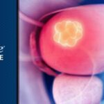 Padcev/Keytruda组合疗法突破：MIBC患者围手术期治疗EFS/OS显著改善，最新方案与获取渠道解析