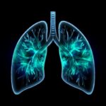 一举两得：利用乳房X光检查，成功提高女性肺癌筛查参与率