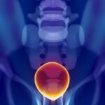 FDA批准IsoPSA：前列腺癌诊断新突破，可减少46%不必要活检