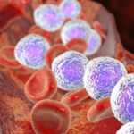 MK-1045在复发/难治性B细胞急性淋巴细胞白血病中展现良好耐受性与显著疗效