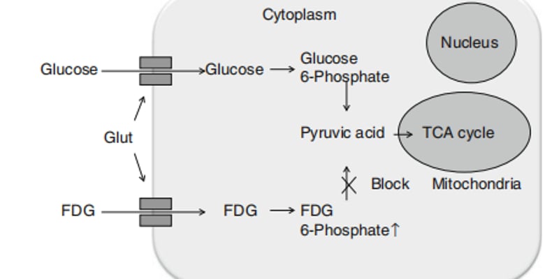 肝癌患者必看：PET-CT的局限与正确检查流程，最新诊疗指南解读