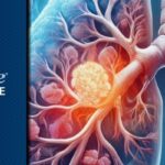 一滴血测肺癌？FirstLook Lung血液检测或将革新肺癌早期筛查模式