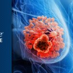 HR+乳腺癌治疗新标准：CDK4/6抑制剂与口服SERD的早期应用及ESR1突变应对策略