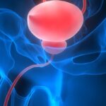 前列腺癌淋巴结转移检测难题：PSMA-PET、CT、MRI准确性研究解读