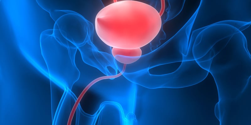 前列腺癌淋巴结转移检测难题：PSMA-PET、CT、MRI准确性研究解读