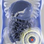 长期大量饮酒如何增加结直肠癌风险？最新临床研究深度解析与预防建议