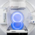 女性盆腔癌放疗新突破：精准保护性器官，提升患者生活质量