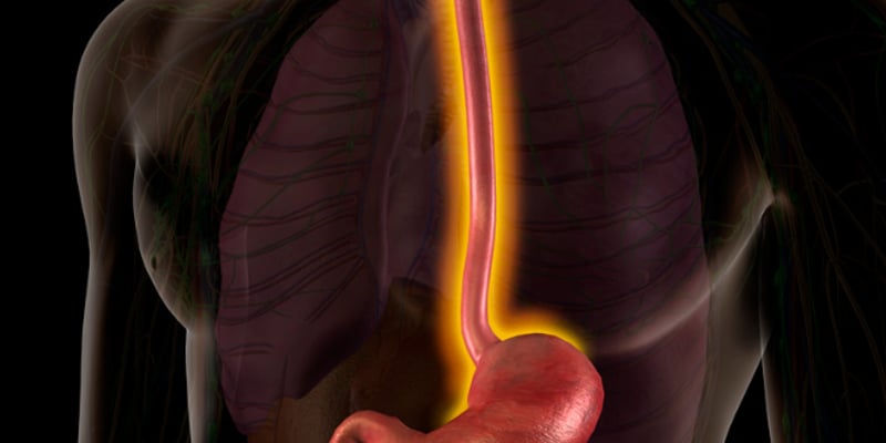 胃癌/胃食管结合部腺癌新突破：CLDN18.2靶向药佐妥昔单抗联合免疫化疗显著延长PFS，附海外购药指南